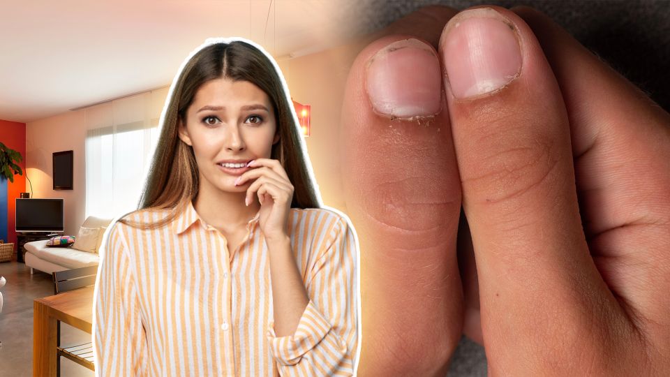 Рискуете оказаться в больнице: этот косметический «дефект» ни в коем случае нельзя запускать