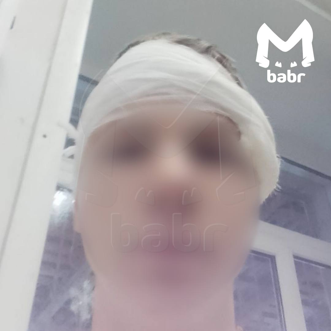 Школьник, ранивший в висок одноклассника строительным патроном в Железногорске-Илимском, отделался штрафом