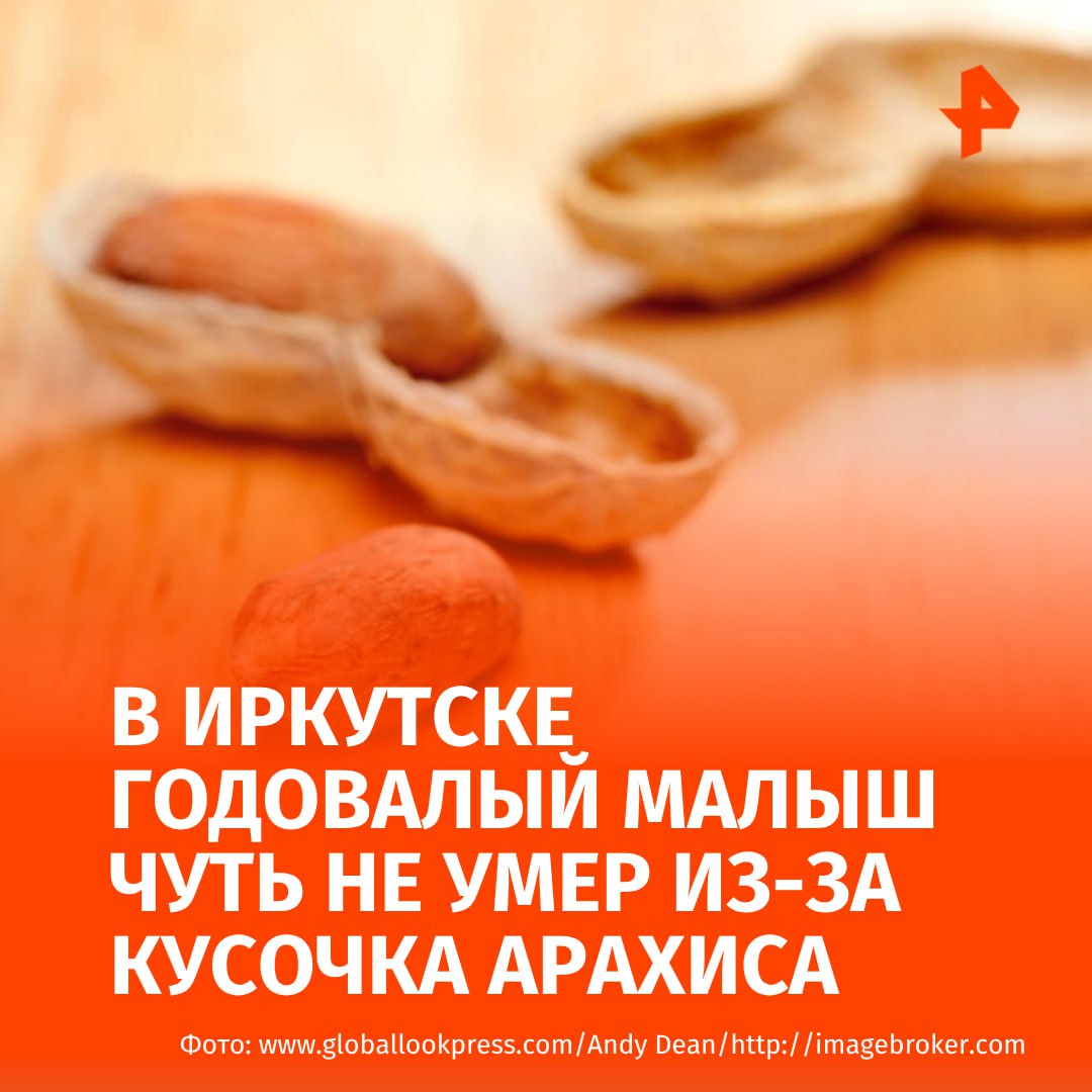 Годовалый малыш едва не погиб из-за кусочка арахиса в легких