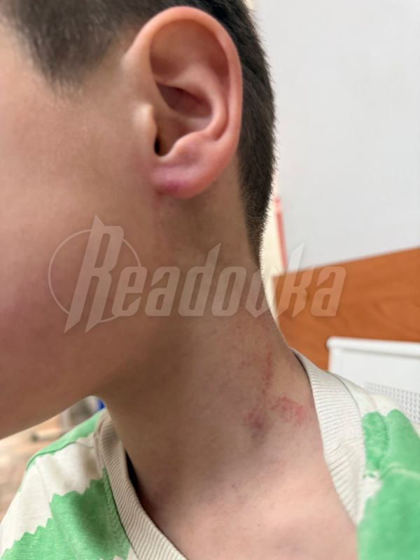 Мэр Иркутского округа опроверг избиение ребенка физруком в детском саду