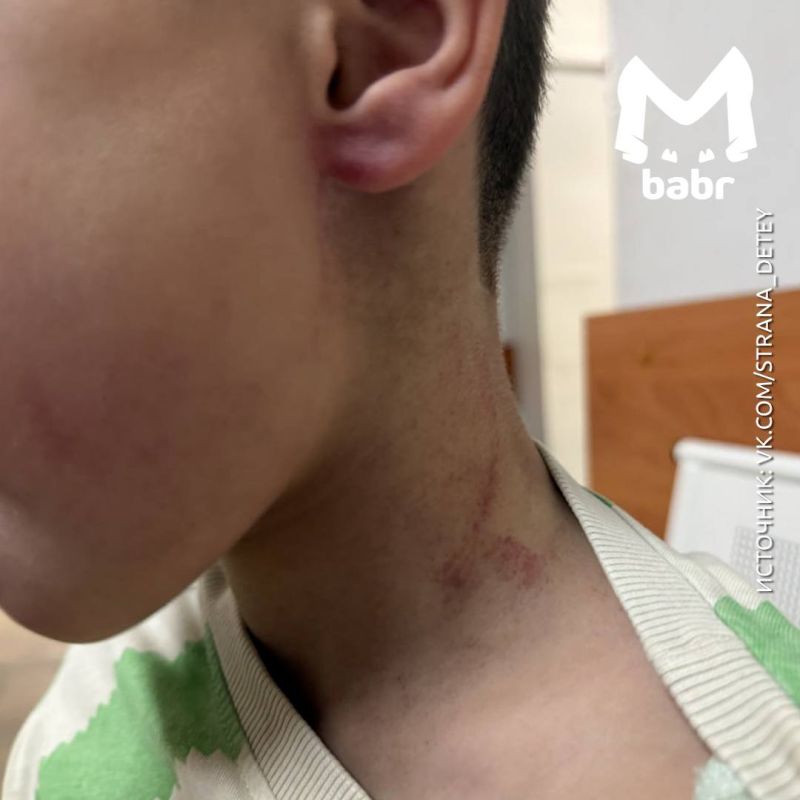 Физрук не трогал ребёнка в детском саду Иркутска, заявил мэр Иркутского округа