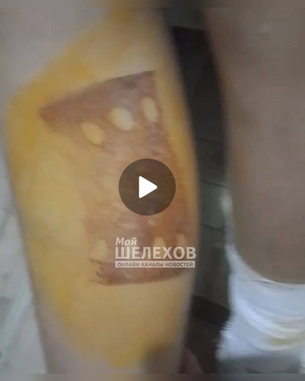 Школьники в Иркутской области прижгли девочке ноги утюгом и избили её шнуром по лицу, чтобы не жаловалась родителям, сообщил источник RT Школьники в Иркутской области прижгли девочке ноги утюгом и избили её шнуром по лицу, чтобы не жаловалась родителям, сообщил источник RT