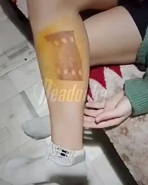 В Иркутской области банда школьников регулярно избивает детей — одной девочке они прижгли утюгом ноги