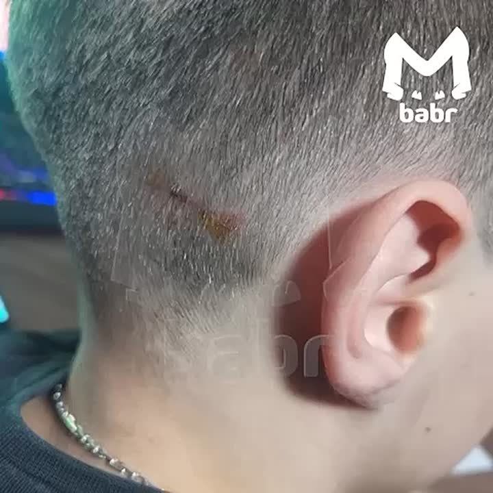 Собака покусала школьника в поселке Улькан