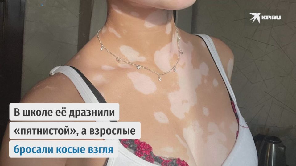 18-летняя Карина Гуреева из Иркутска давно свыклась с удивленными взглядами окружающих