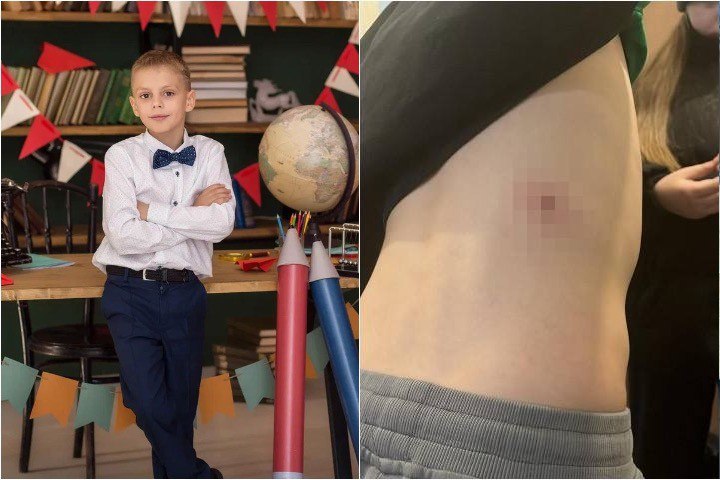 «Мама, мне ногу прокусили!»: на восьмилетнего мальчика дважды напали бродячие собаки в Иркутске