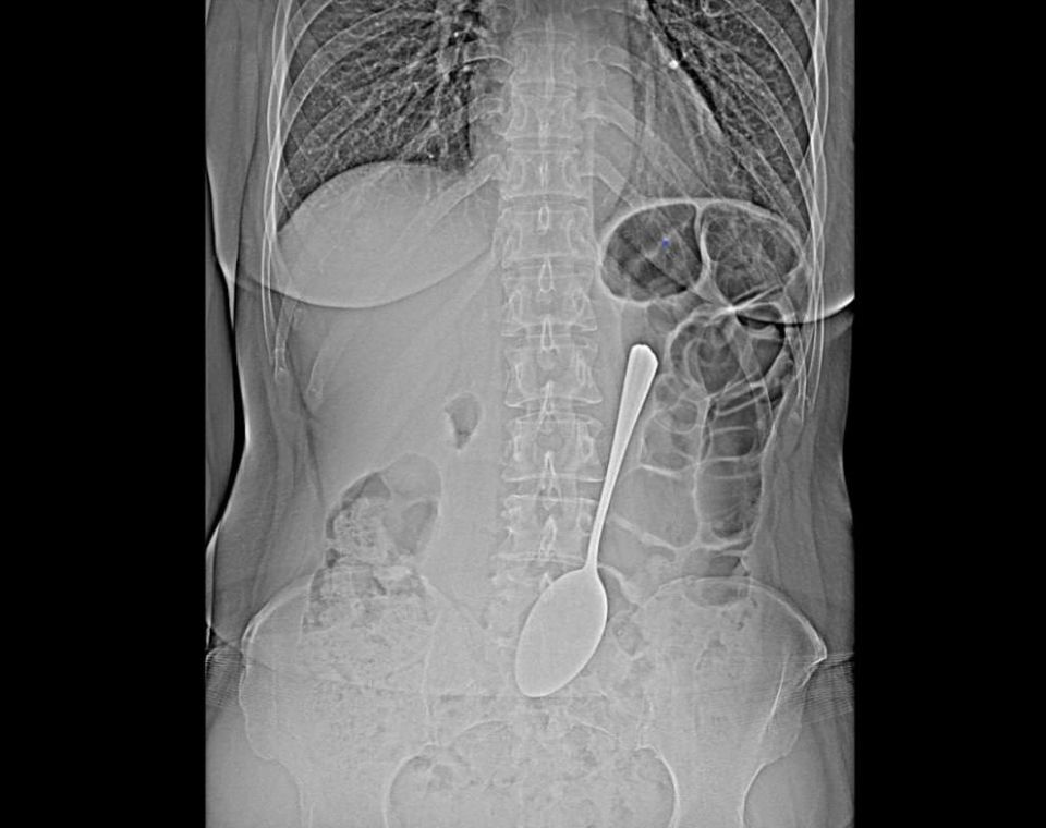 Так вкусно, что пальчики оближешь или… ложку проглотишь! Да-да, вы не ослышались