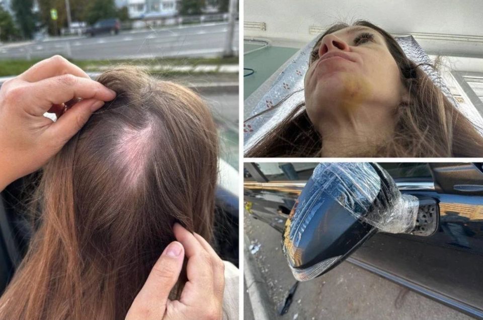 После этого случая женщина навсегда забыла про работу в такси: «За отказ он бил меня по голове и залил «перцовкой» глаза»