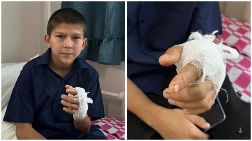 «Мама, я отрубил себе палец!» — с этими словами 12-летний Султан вбежал в дом