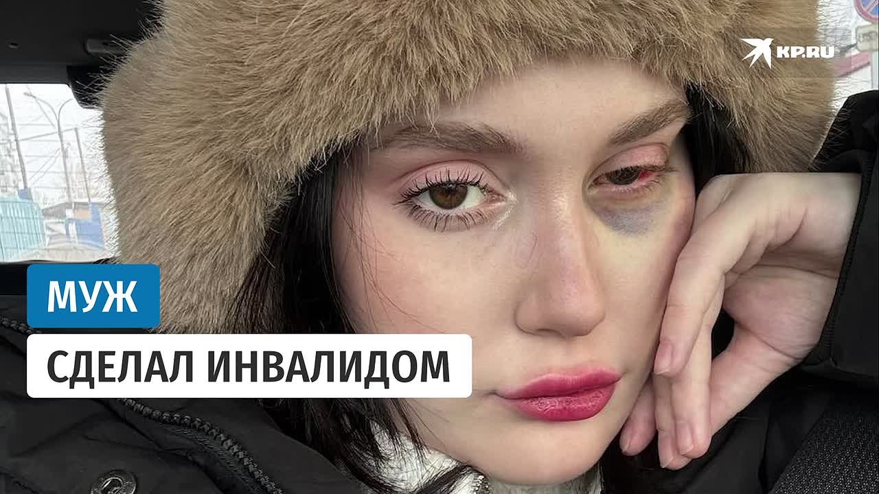 23-летняя Марьяна Москалева из Братска будет выступать в суде как потерпевшая против своего бывшего мужа, который, по ее словам, одним ударом кулака в лицо сделал ее инвалидом
