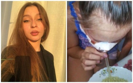 «Пес вцепился в лицо, когда она наклонилась за велосипедом»