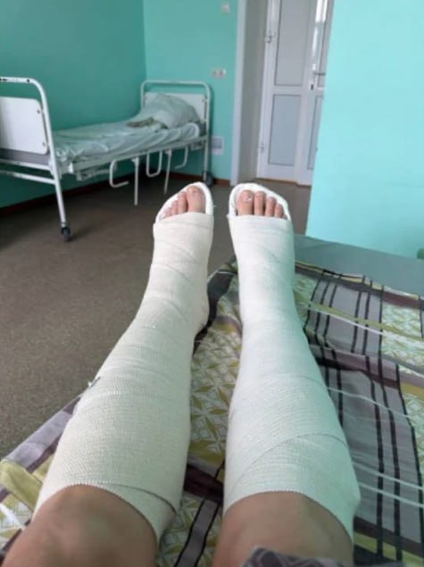 Мать двоих детей получила перелом обеих ног, ее сбил хивус на льду Байкала Мать двоих детей получила перелом обеих ног, ее сбил хивус на льду Байкала