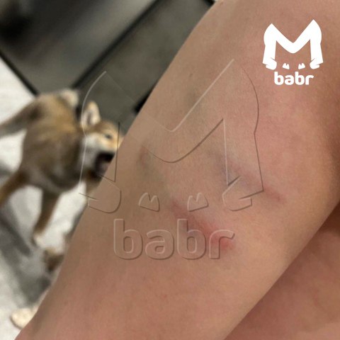 Стаи бродячих собак кидаются на детей в иркутском садоводстве Стаи бродячих собак кидаются на детей в иркутском садоводстве