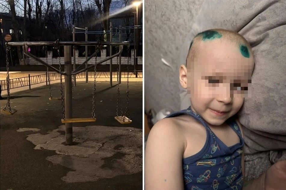 «Сын орал, а из головы хлестала кровь»: 6-летний мальчик выжил после того, как на него упали качели