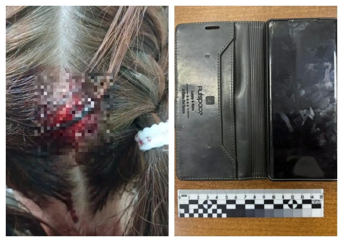 «Голова и куртка были в крови»: прохожий разбил голову 11-летней девочке телефоном за грубый ответ в Бурятии