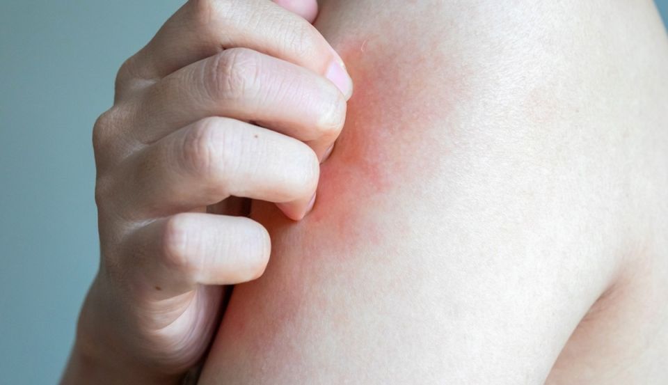 ����� ��� ���������� ��������: ������� ������ ����� ����